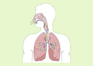 Cáncer pulmón